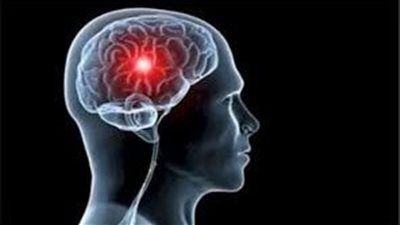 منتج شائع في المنازل قد يسبب سكتة دماغية.. ما هو المحلول الذي نحذر منه؟ - الخليج الان