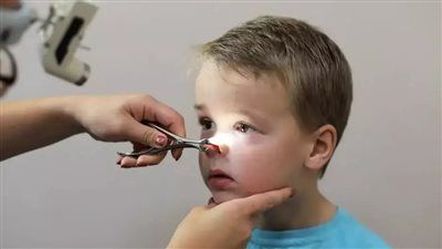 لحمية الأنف عند الأطفال.. متى تتحول إلى خطر وتستدعي تدخلًا فوريًا؟ - الخليج الان