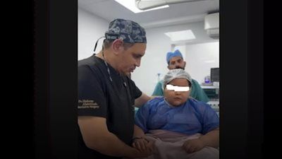 من غرفة العمليات إلى نقابة الأطباء.. القصة الكاملة لعملية تكميم طفلة - الخليج الان