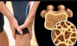 أطعمة احرص عليها بعد سن الثلاثين لصحة عظامك