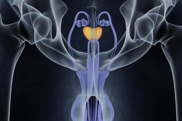 إنجاز علمي جديد لعلاج سرطان البروستاتا بـ"صبغة متوهجة"