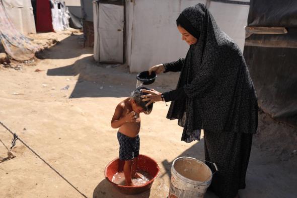 أمراض جلدية وأوبئة قاتلة.. مصير محفوف بالمخاطر للغزيين في مخيمات النزوح